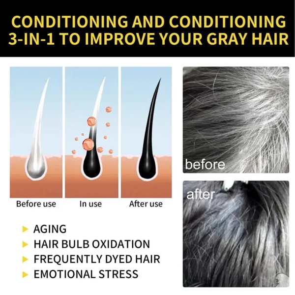 Magic Natural HerRhHair Dye Shampoo, 3 en 1 Hair Document Shampooing pour Cheveux Gary, Brun Foncé, Noir, Femmes et Hommes, Couverture Grise, 100ml - Image 2